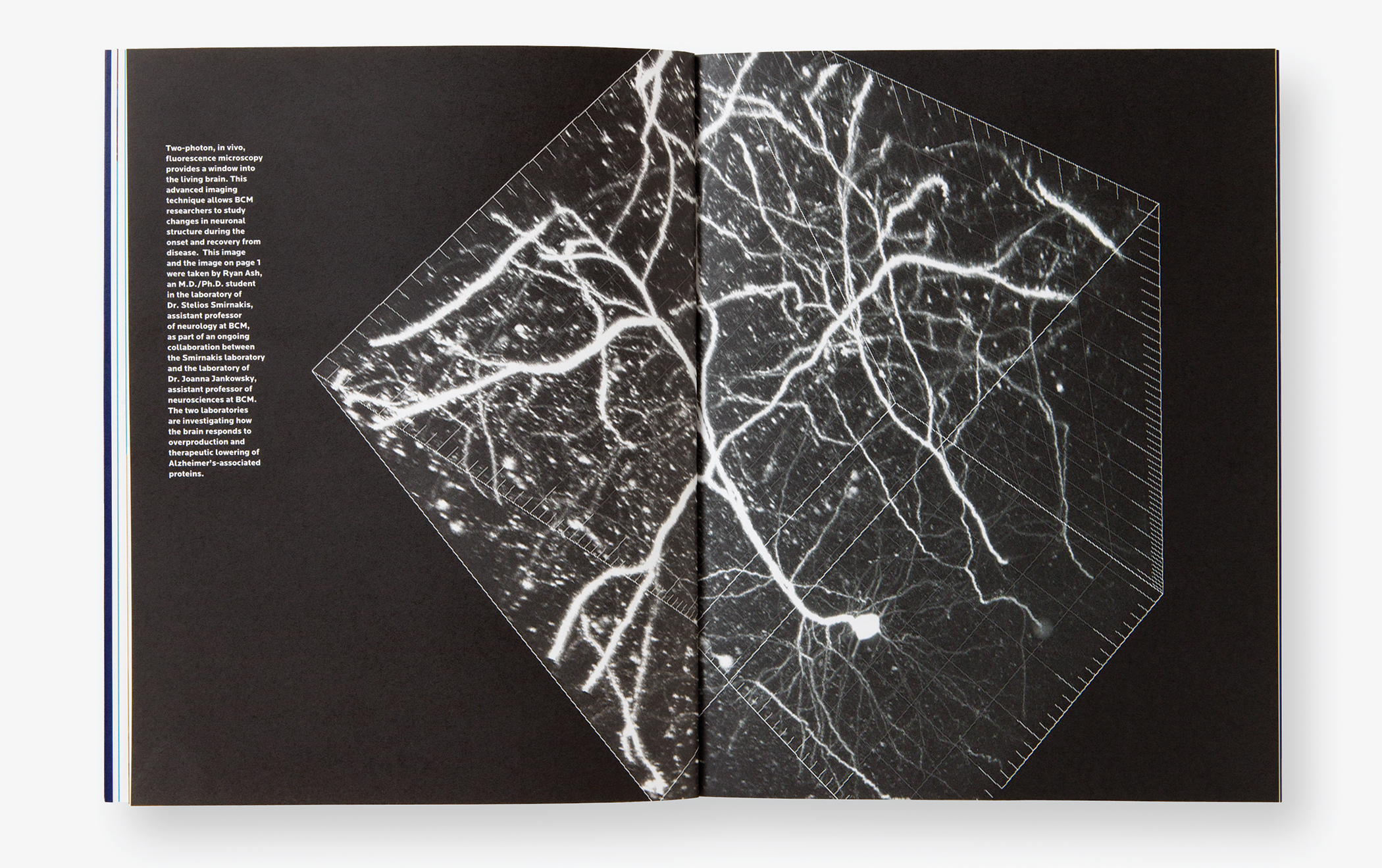 Pages from The BCM Report with images of human brain using fluorescent microscopy.